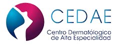 cedae
